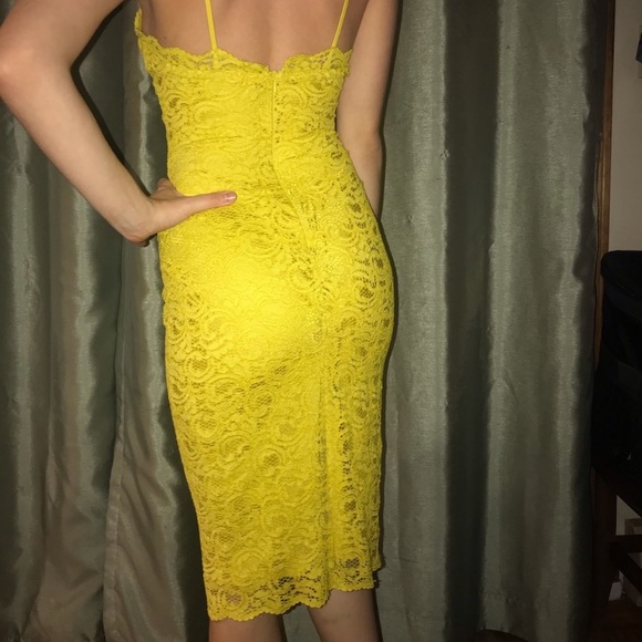 Zara Yellow Lace Overlay Dress - Picture 5 of 12